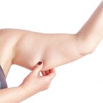 Is Liposuction To Arm Possible